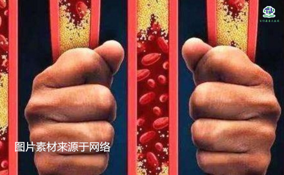 不想給血管&ldquo;添堵&rdquo;，盡量少吃以下這些東西，或許能讓腦梗離遠些  